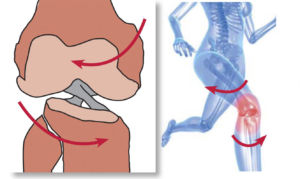 sports injury while running